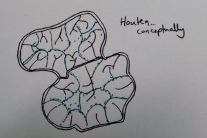 A conceptual drawing of Houten's neighborhood compartmentalization 
